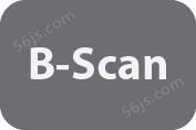 B-Scan Display Mode